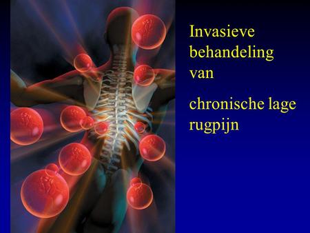 Invasieve behandeling van chronische lage rugpijn.