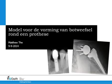 9-9-2014 Challenge the future Delft University of Technology Model voor de vorming van botweefsel rond een prothese Matthew The.