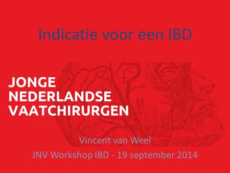 Vincent van Weel JNV Workshop IBD - 19 september 2014