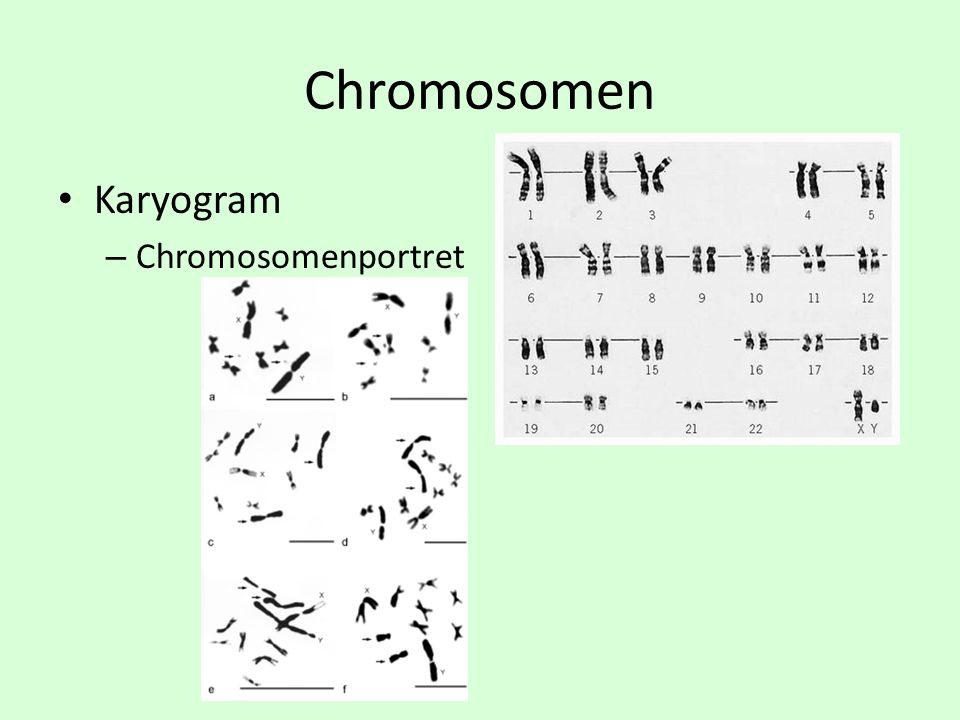 Chromosomen Karyogram Chromosomenportret