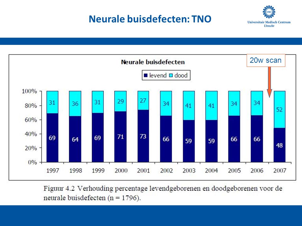 Neurale buisdefecten: TNO