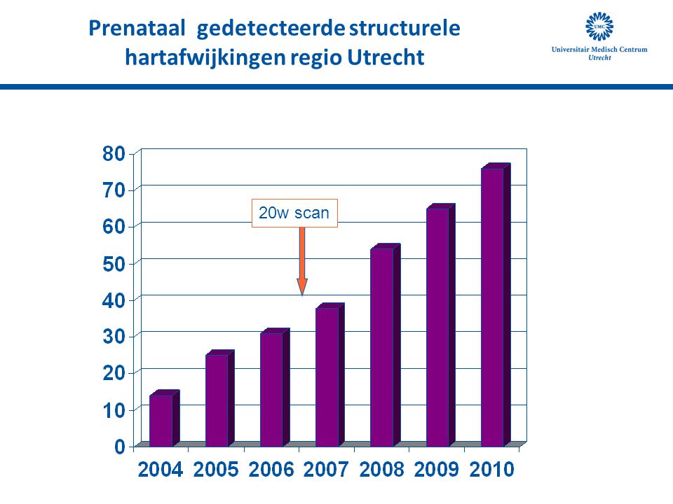 Prenataal gedetecteerde structurele hartafwijkingen regio Utrecht