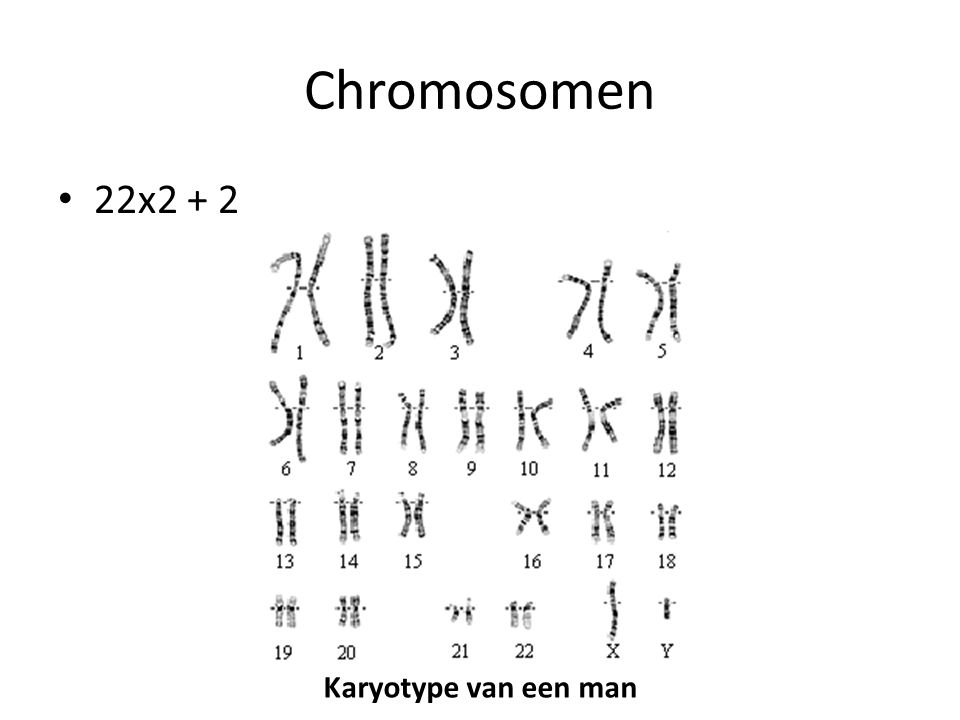 Chromosomen 22x2 + 2 Karyotype van een man