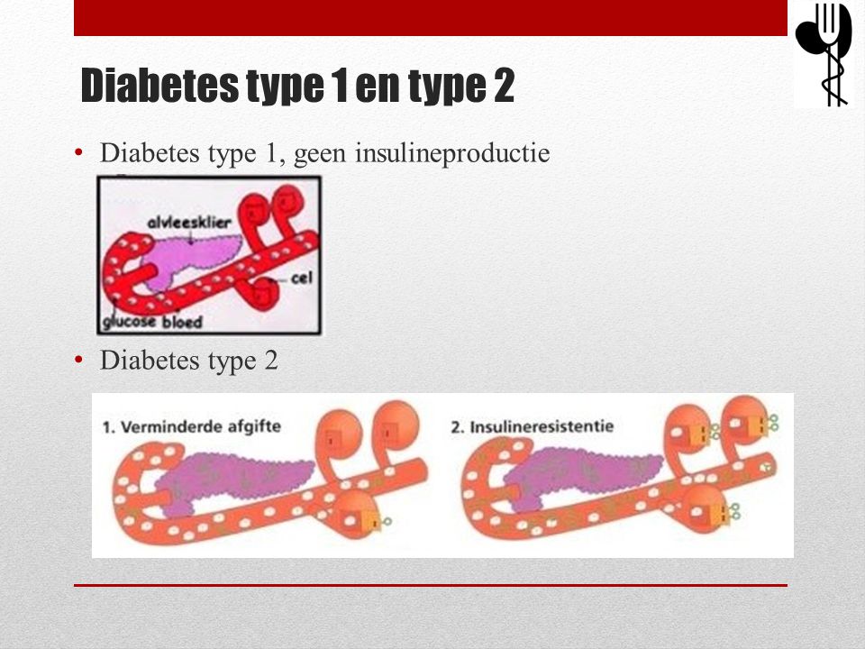 Diabetes type 1 en type 2 Diabetes type 1, geen insulineproductie