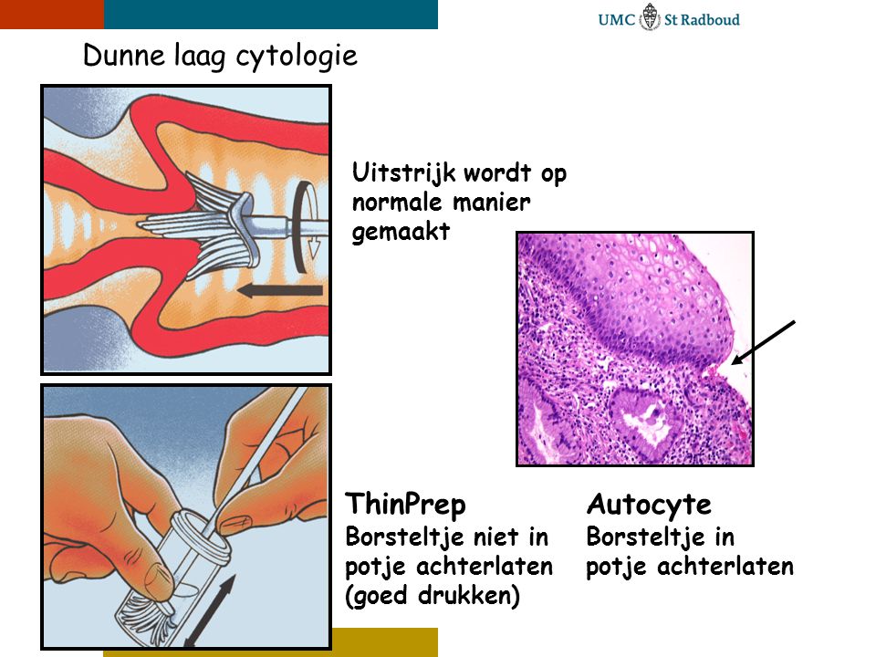 Dunne laag cytologie ThinPrep Autocyte