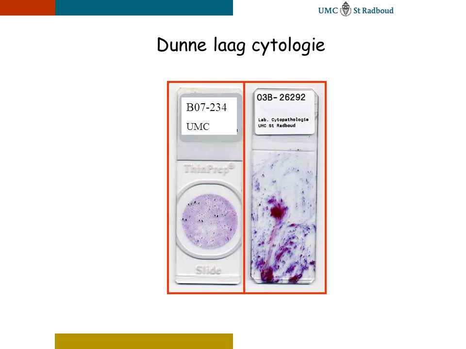 Dunne laag cytologie B UMC