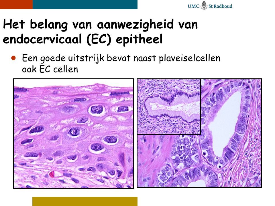 Het belang van aanwezigheid van endocervicaal (EC) epitheel