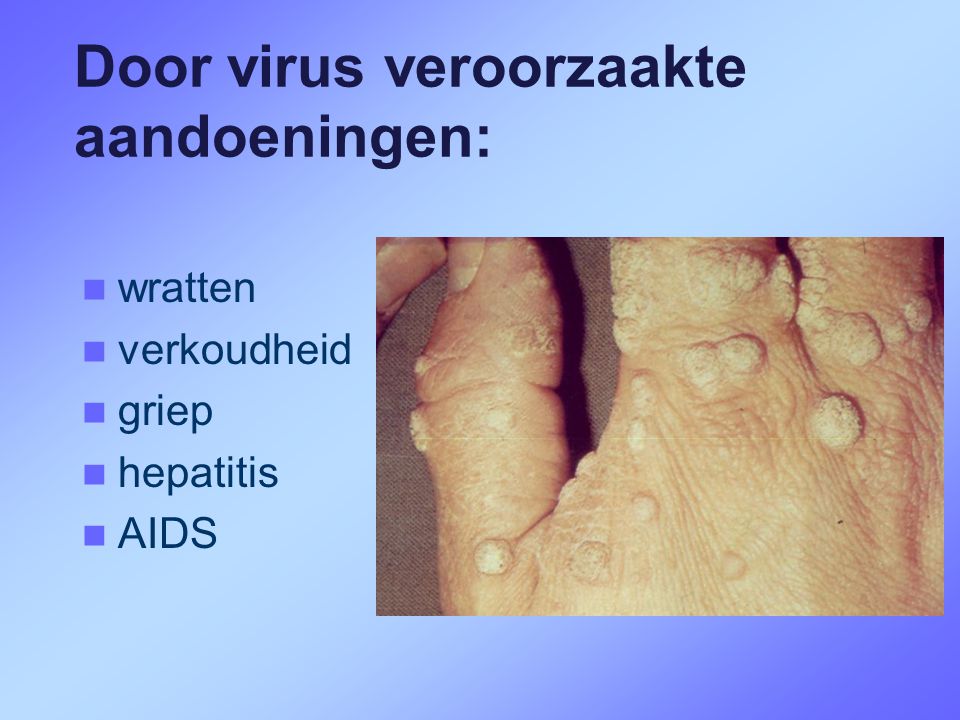 Door virus veroorzaakte aandoeningen: