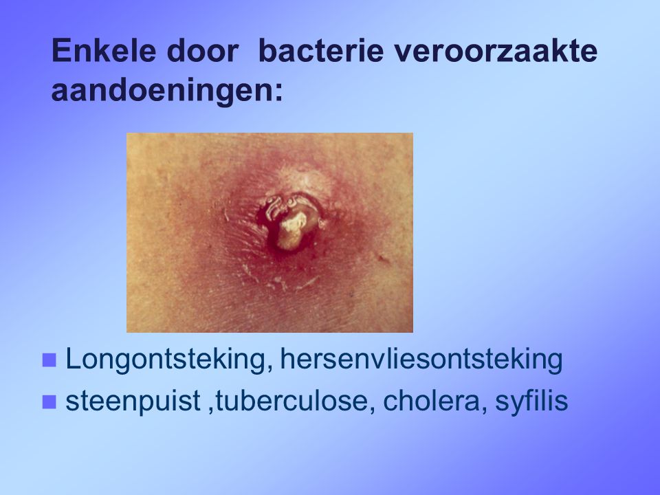 Enkele door bacterie veroorzaakte aandoeningen:
