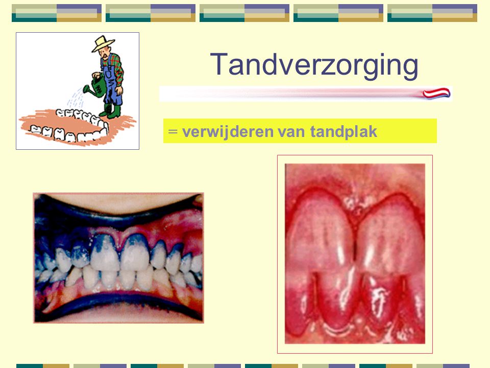 Tandverzorging = verwijderen van tandplak