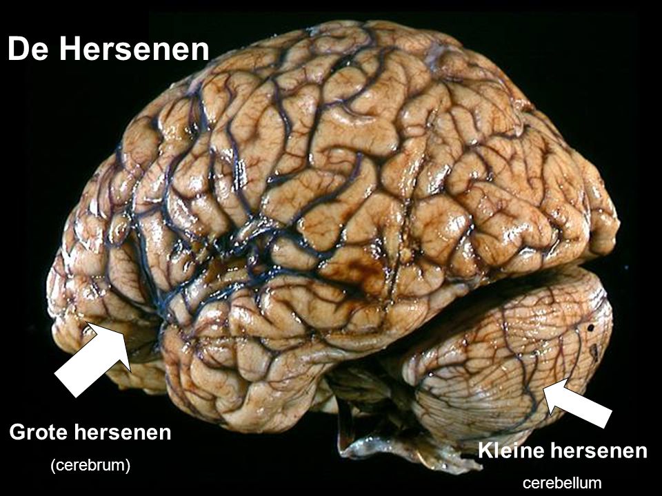 De Hersenen Grote hersenen (cerebrum) Kleine hersenen cerebellum