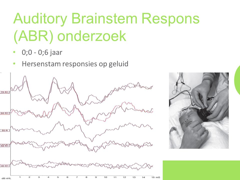 Auditory Brainstem Respons (ABR) onderzoek