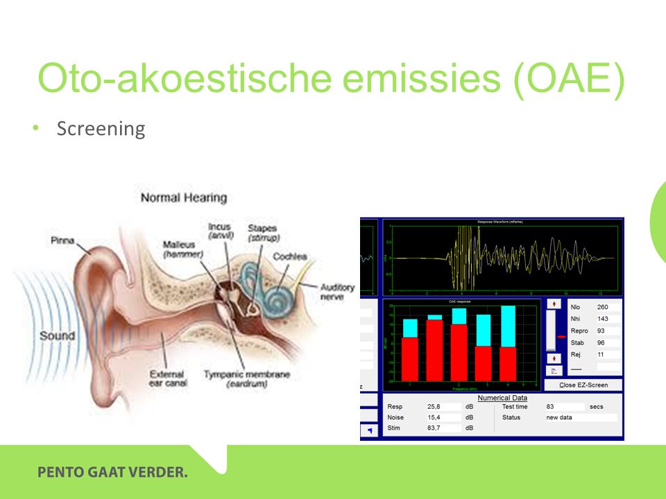 Oto-akoestische emissies (OAE)