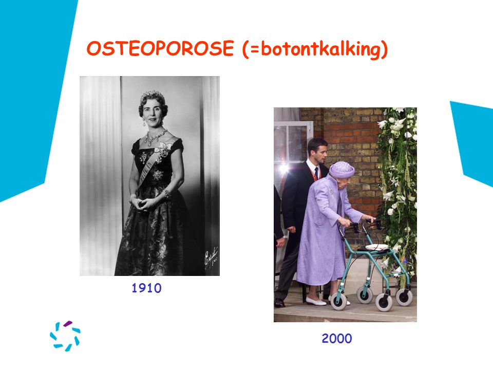 OSTEOPOROSE (=botontkalking)