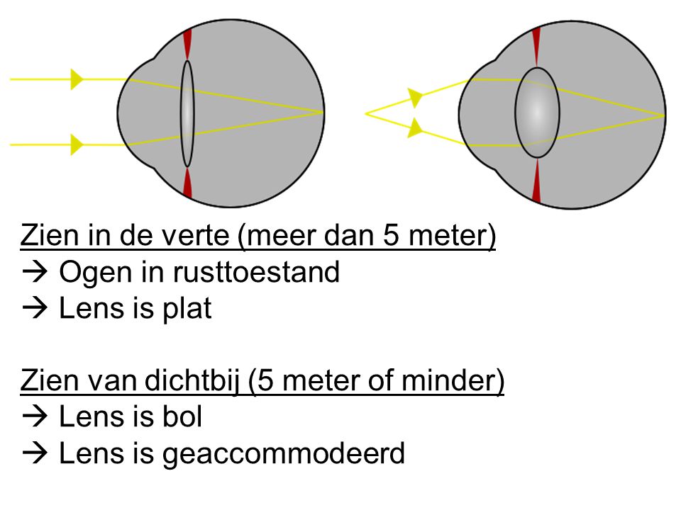 Zien in de verte (meer dan 5 meter)  Ogen in rusttoestand  Lens is plat Zien van dichtbij (5 meter of minder)  Lens is bol  Lens is geaccommodeerd