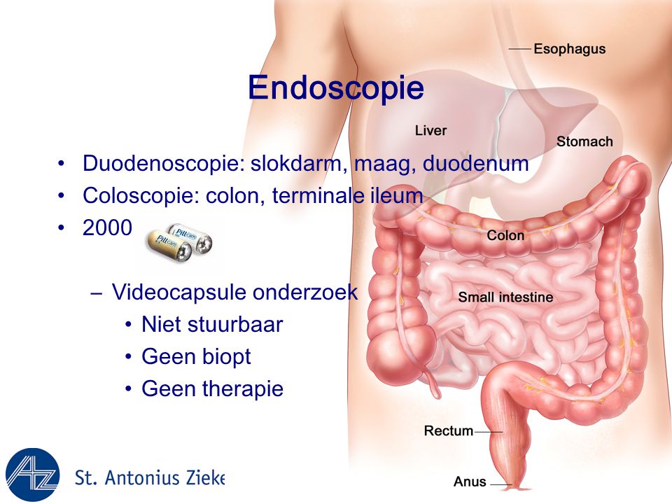 Endoscopie Duodenoscopie: slokdarm, maag, duodenum