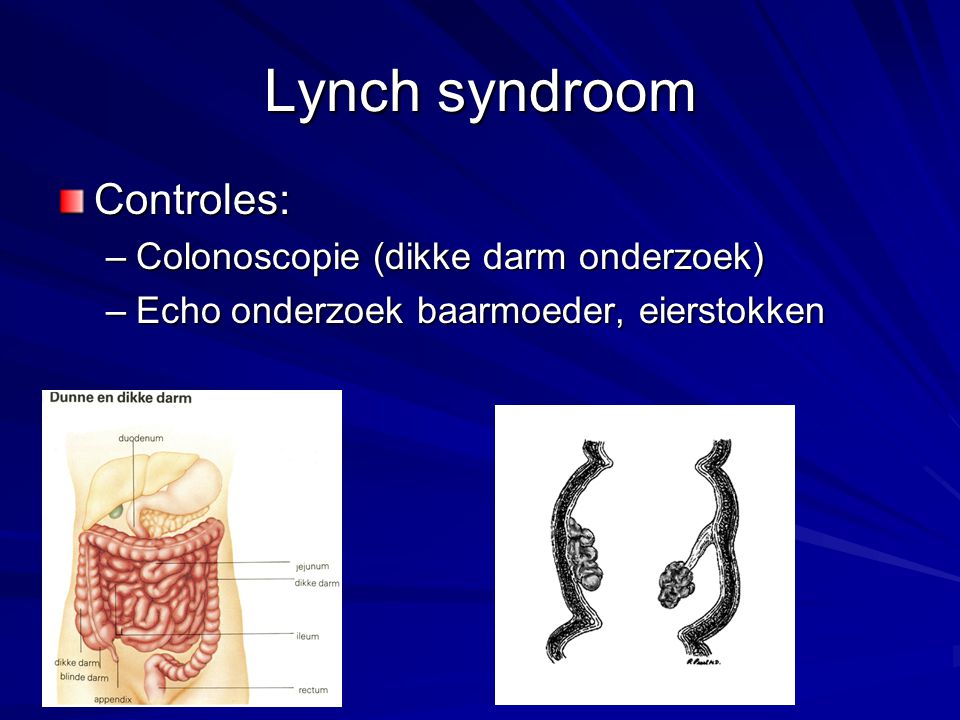Lynch syndroom Controles: Colonoscopie (dikke darm onderzoek)