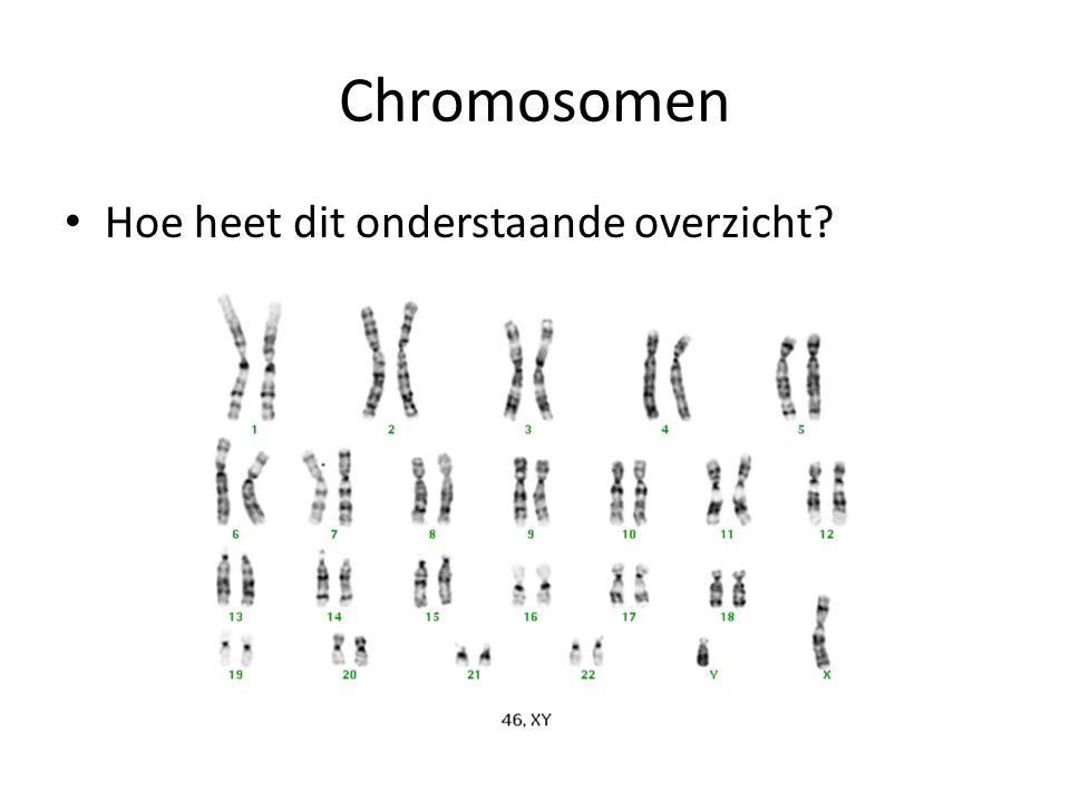 Chromosomen Hoe heet dit onderstaande overzicht