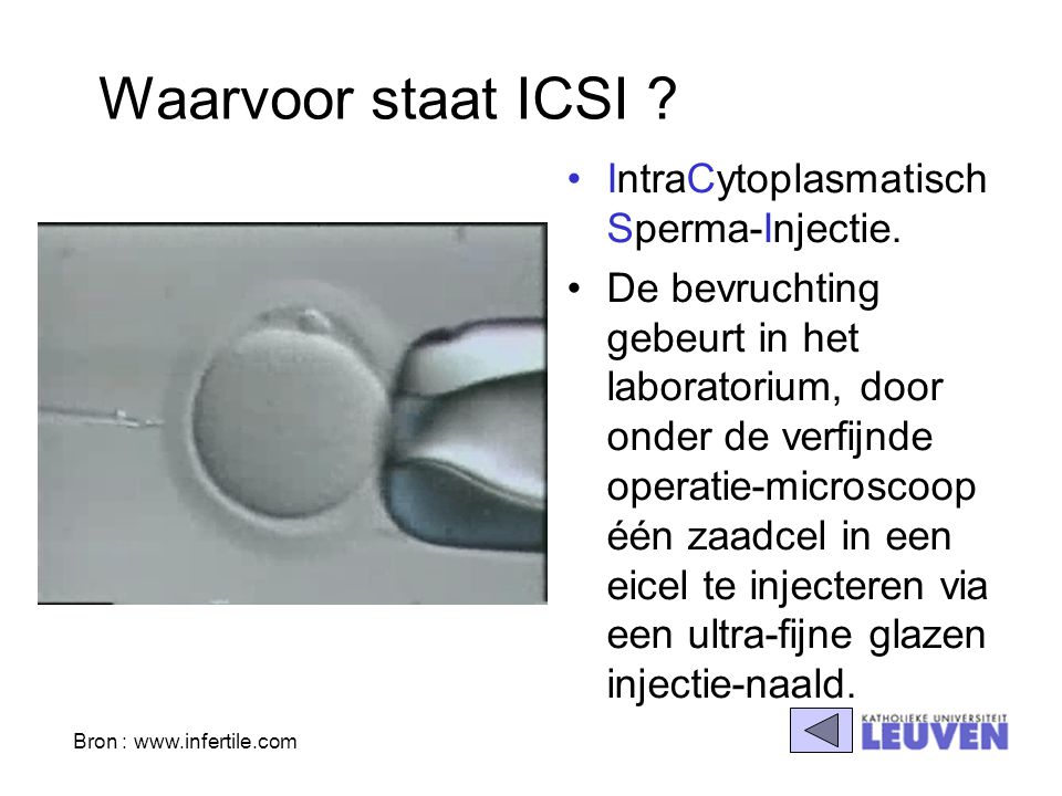 Waarvoor staat ICSI IntraCytoplasmatisch Sperma-Injectie.