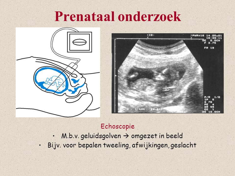 Prenataal onderzoek Echoscopie M.b.v. geluidsgolven  omgezet in beeld