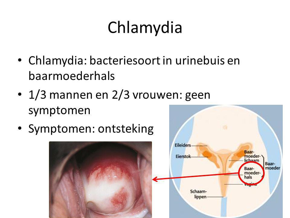 Chlamydia Chlamydia: bacteriesoort in urinebuis en baarmoederhals