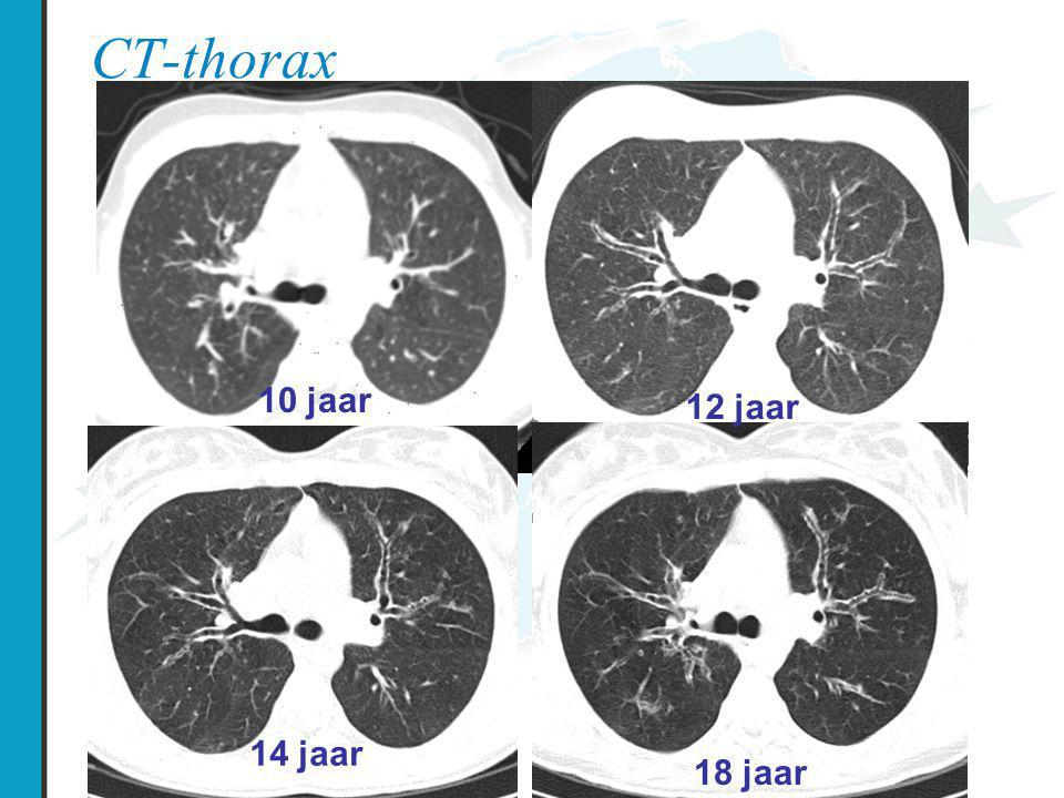 CT-thorax 10 jaar 12 jaar 14 jaar 18 jaar
