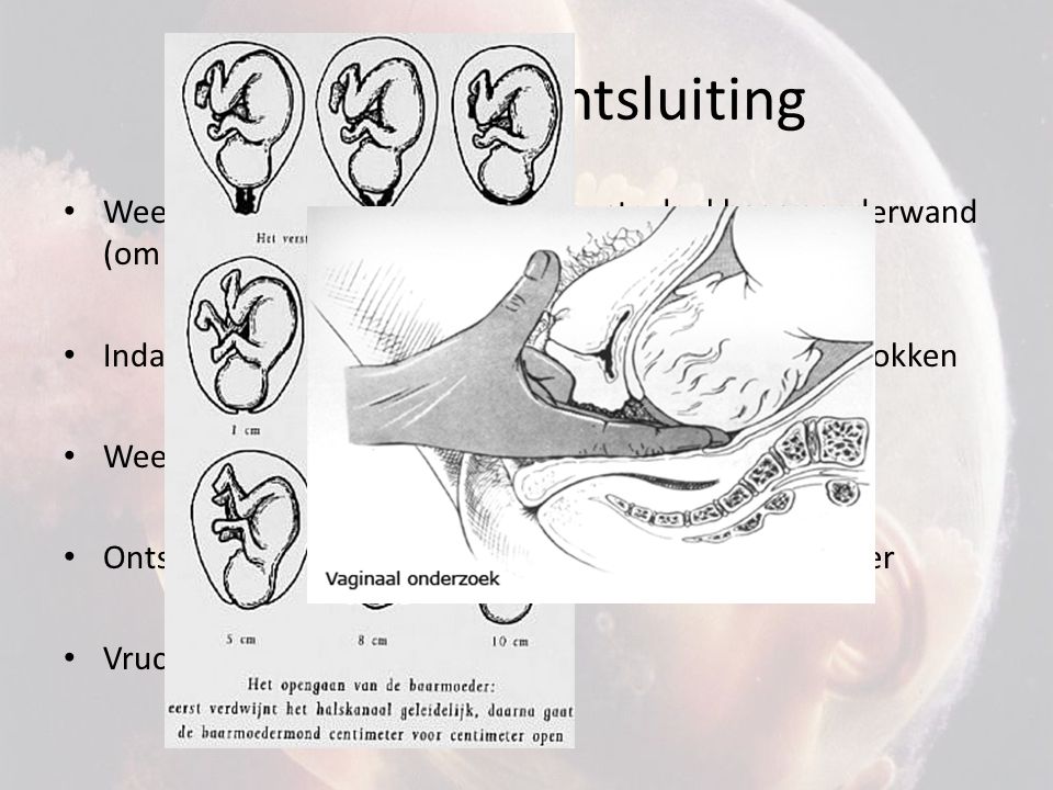 Fase 1: De ontsluiting Weeën: door samentrekking bovenste deel baarmoederwand (om de min)
