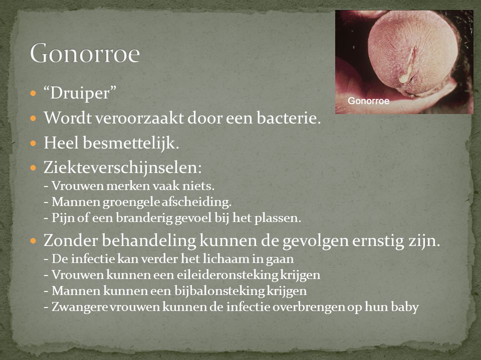 Gonorroe Druiper Wordt veroorzaakt door een bacterie.