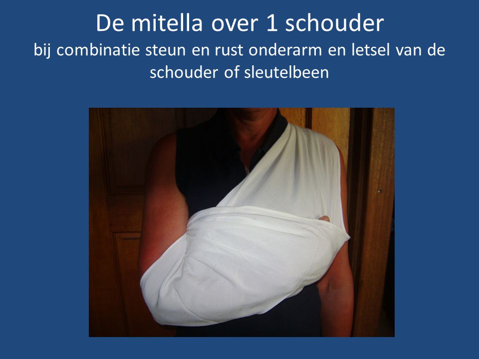 De mitella over 1 schouder bij combinatie steun en rust onderarm en letsel van de schouder of sleutelbeen