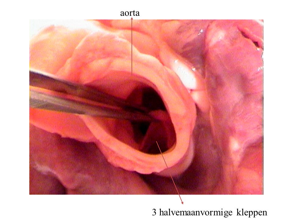 aorta 3 halvemaanvormige kleppen