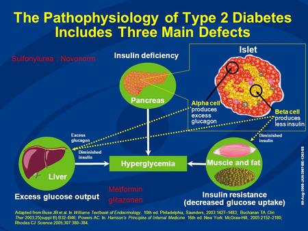 The Pathophysiology of Type 2 Diabetes Includes Three Main Defects