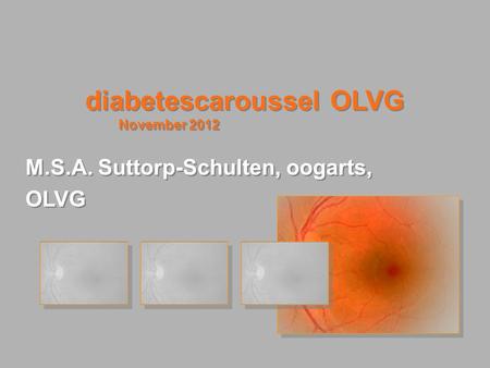diabetescaroussel OLVG