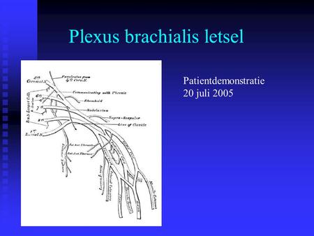 Plexus brachialis letsel
