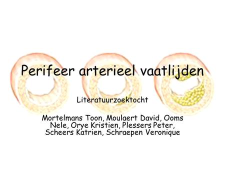 Perifeer arterieel vaatlijden