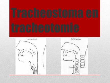 Tracheostoma en tracheotomie