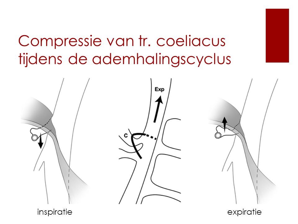 Compressie van tr. coeliacus tijdens de ademhalingscyclus