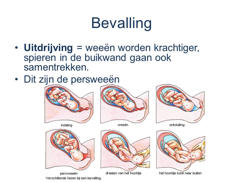 Bevalling Uitdrijving = weeën worden krachtiger, spieren in de buikwand gaan ook samentrekken.
