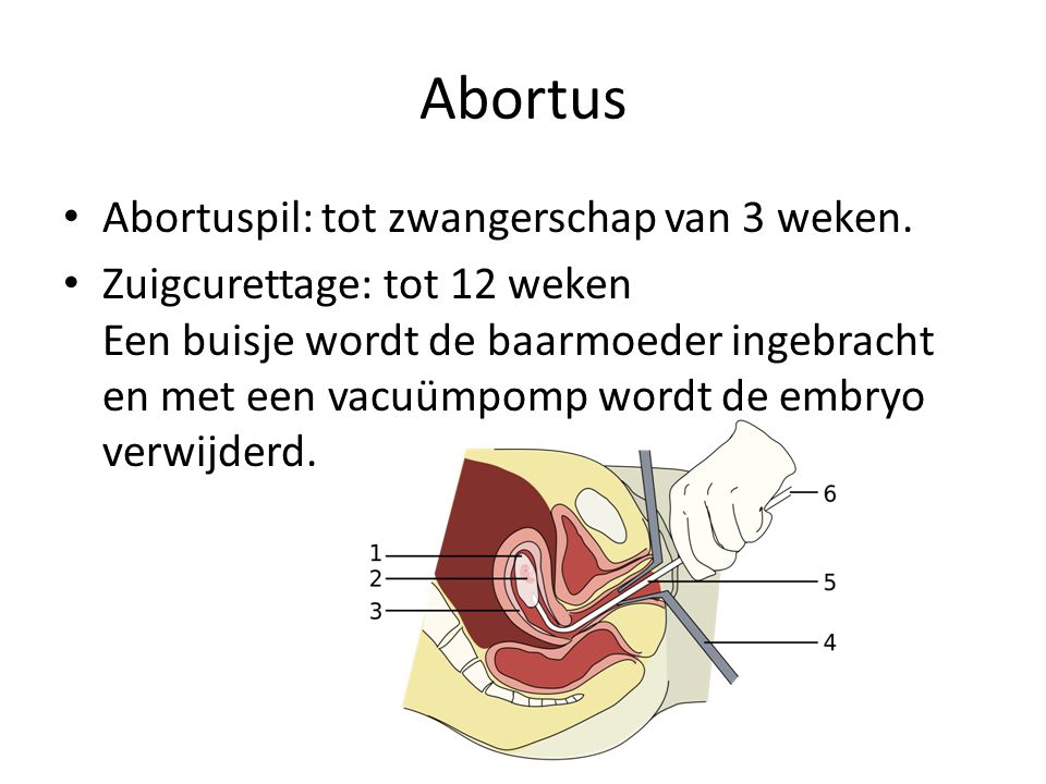 Abortus Abortuspil: tot zwangerschap van 3 weken.