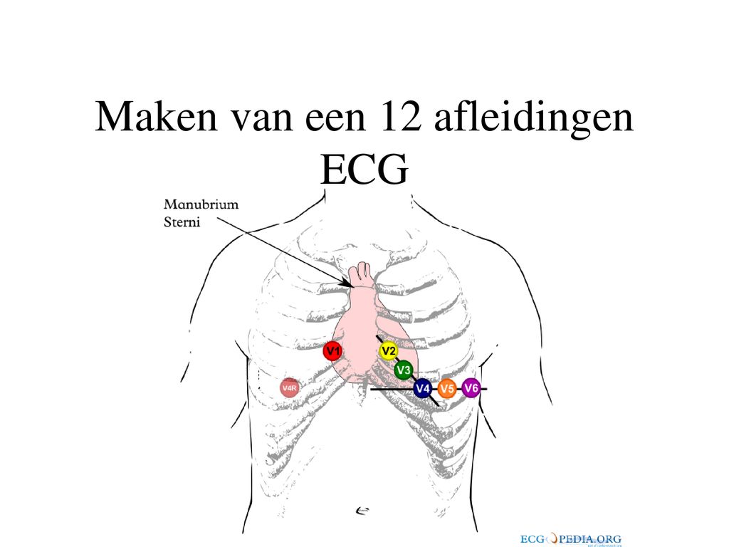 Maken van een 12 afleidingen ECG