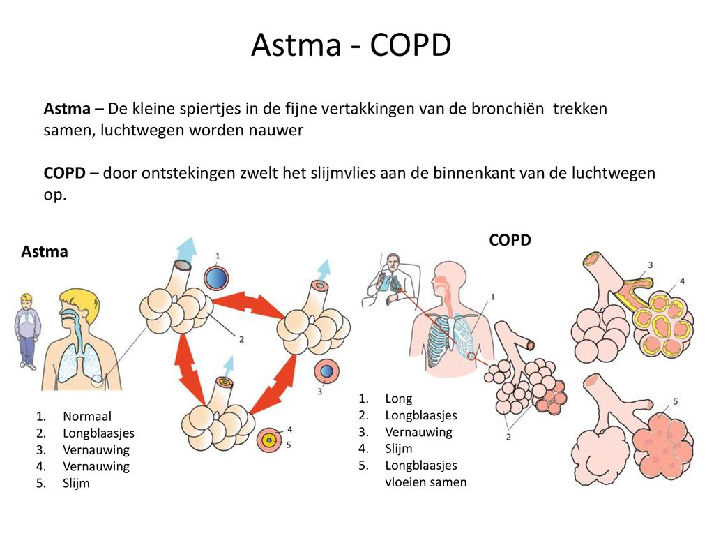 Astma - COPD Astma – De kleine spiertjes in de fijne vertakkingen van de bronchiën trekken samen, luchtwegen worden nauwer.