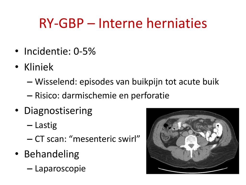 RY-GBP – Interne herniaties