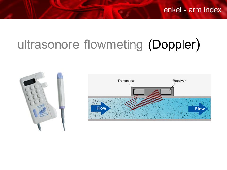 ultrasonore flowmeting (Doppler)