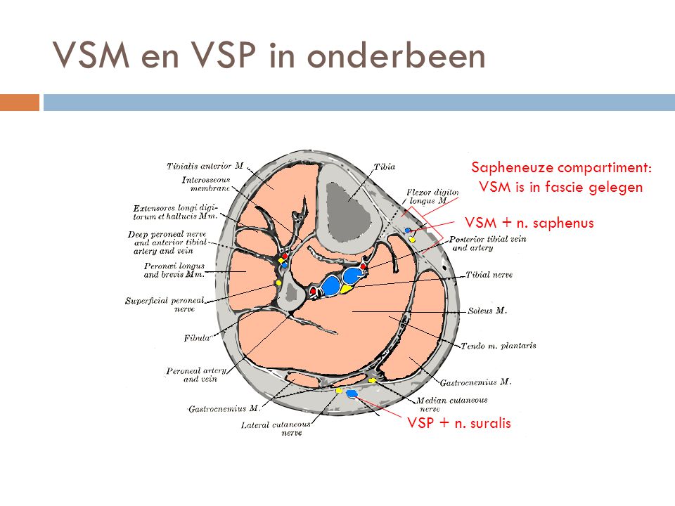 VSM en VSP in onderbeen Sapheneuze compartiment: