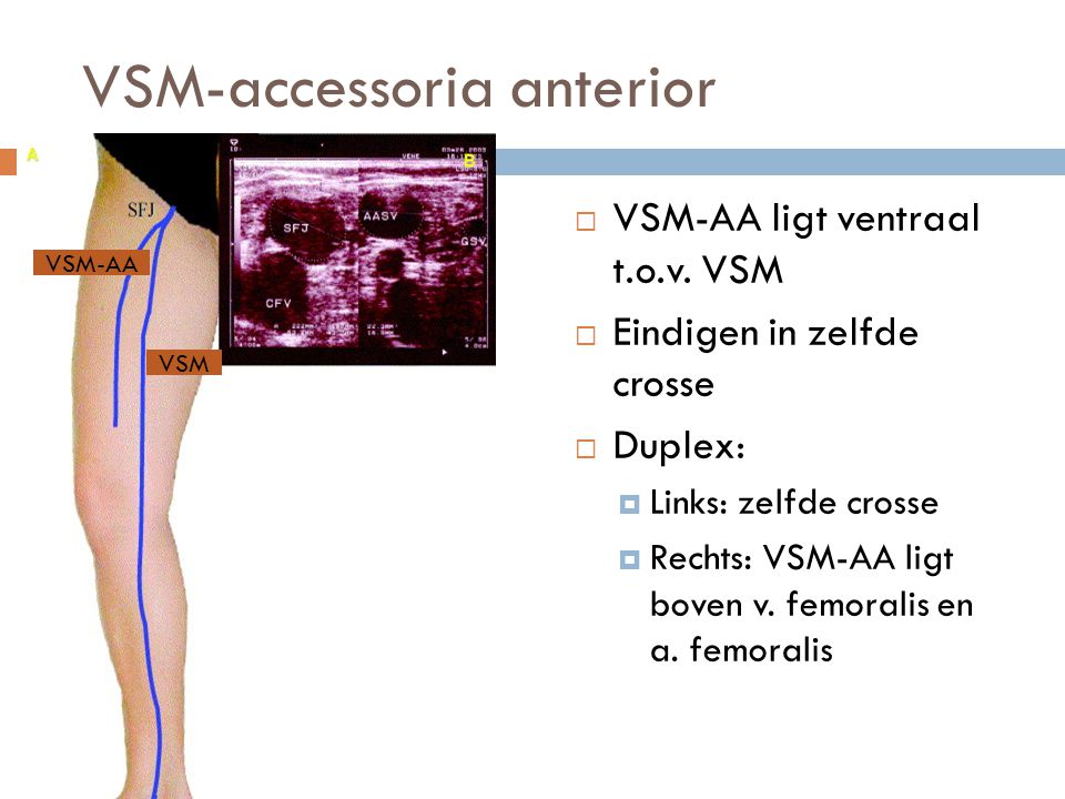 VSM-accessoria anterior