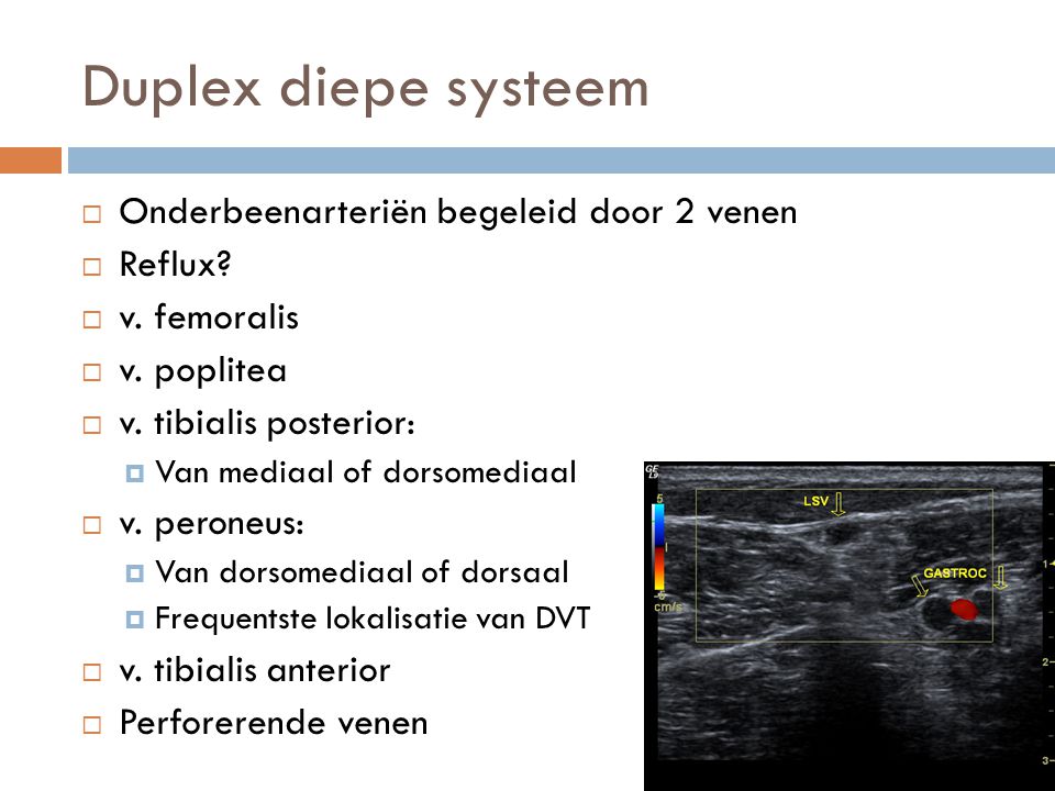 Duplex diepe systeem Onderbeenarteriën begeleid door 2 venen Reflux