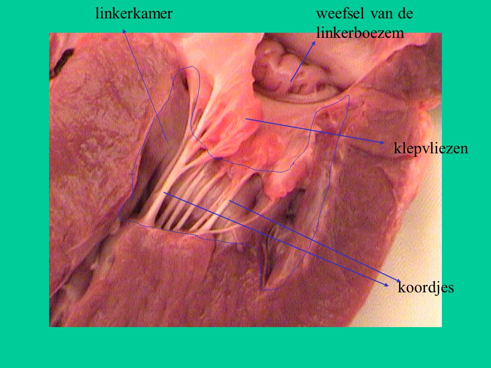 linkerkamer weefsel van de linkerboezem klepvliezen koordjes