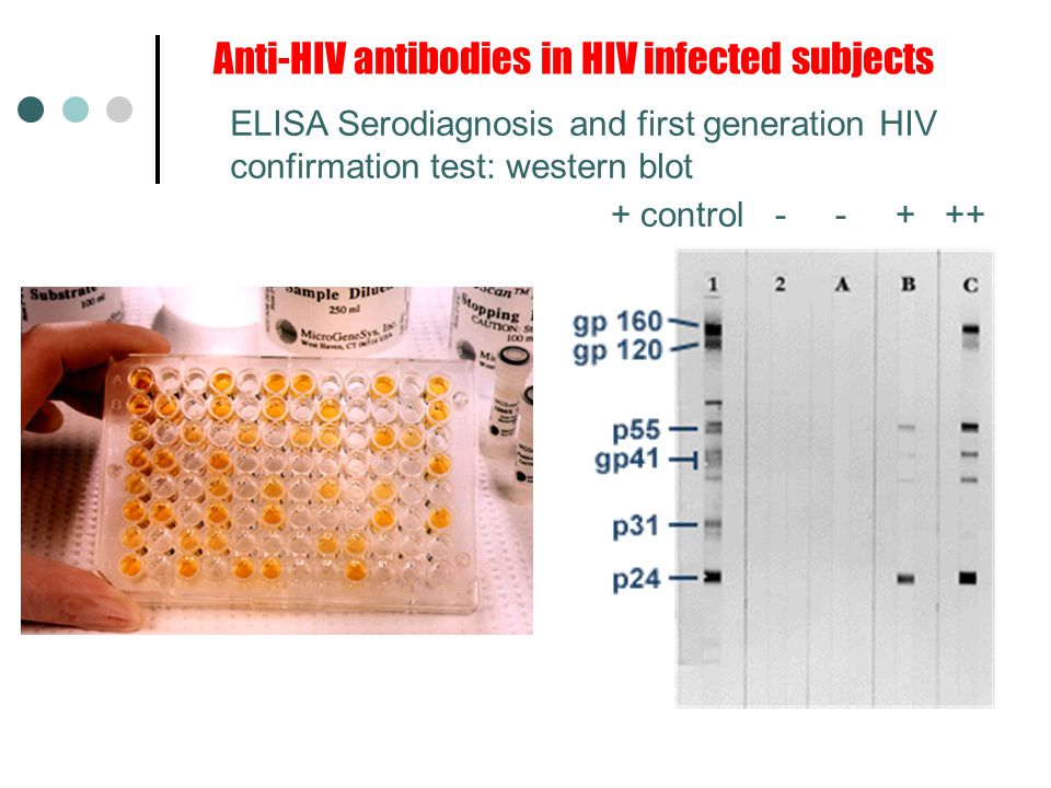 Anti-HIV antibodies in HIV infected subjects