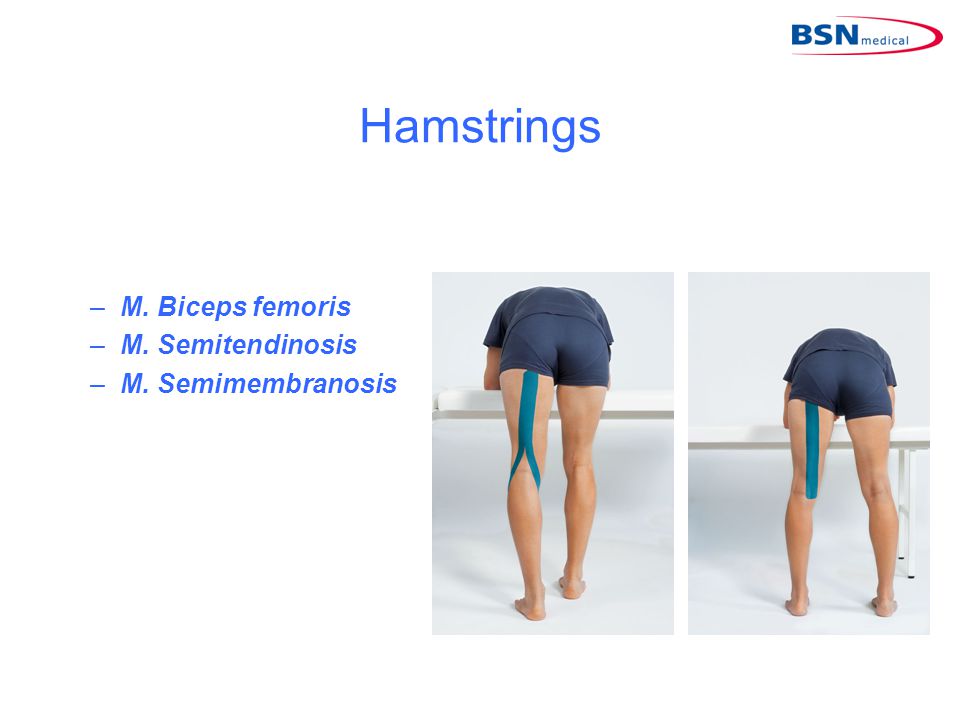 Hamstrings M. Biceps femoris M. Semitendinosis M. Semimembranosis