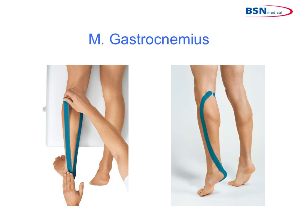 M. Gastrocnemius
