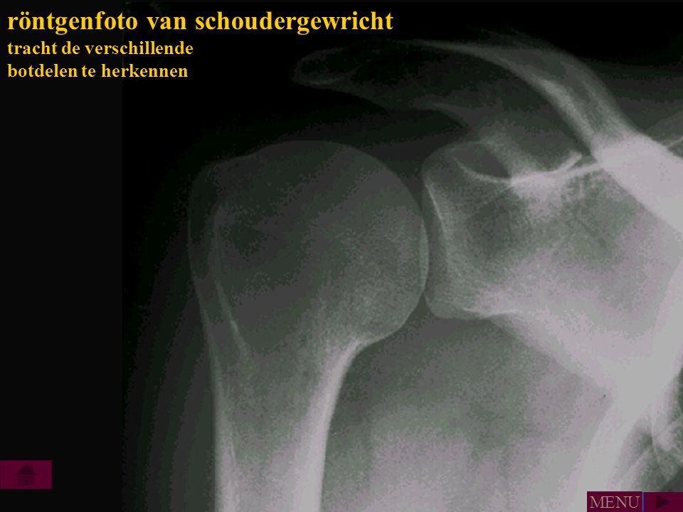 röntgenfoto van schoudergewricht